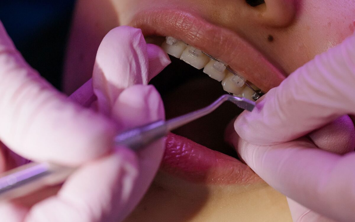 SEO for Orthodontists in Chicago