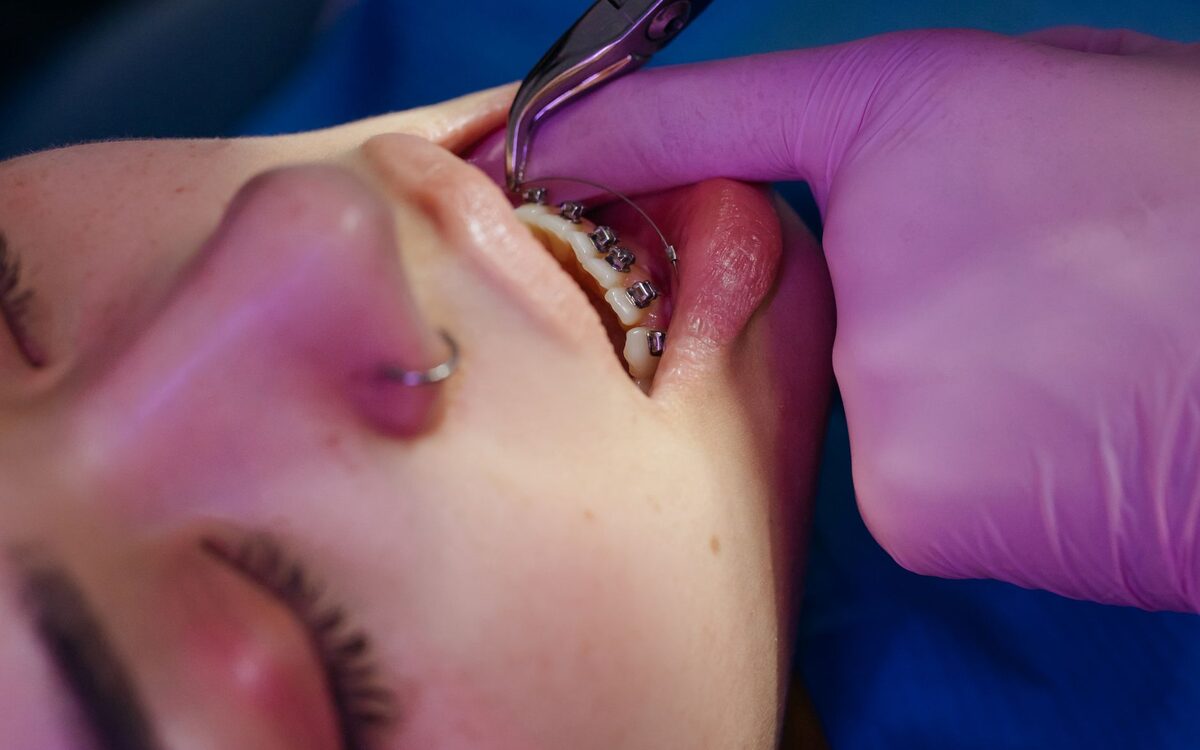 SEO for Orthodontists in Chicago